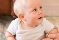 Treating Baby Cradle Cap with Coconut Oil: Gentle Step-by-Step Guide