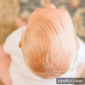 Treating Baby Cradle Cap with Coconut Oil: Gentle Step-by-Step Guide 4 img 11822 3